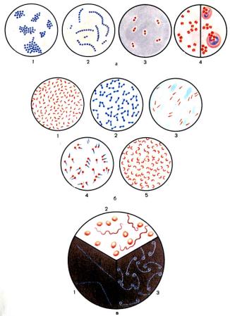формы микроорганизмов и методы их окраски. а - шаровидные бактерии