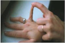 пассивное приведение 1-х пальцев кисти к внутренней поверхности предплечий (по 1 баллу для каждого пальца)