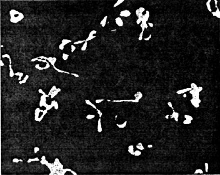 микоплазмы, растущие в питательном растворе клетки возбудителя бронхопневмонии крыс; электронная микрофотография, 11 200 х (клейнбергер-нобель е., 1955)