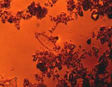 фотографии микроводорослей под микроскопом (увеличение в 400раз