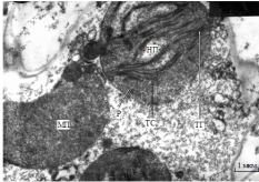 гетеропластидная клетка пестролистного мутанта подсолнечника