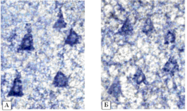 активность г-6-фдг в нейронах 5 слоя фронтальной коры[16]