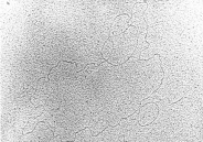 электронная микрофотография кольцевой молекулы хпднк подсолнечника (инбредная линия 3629)