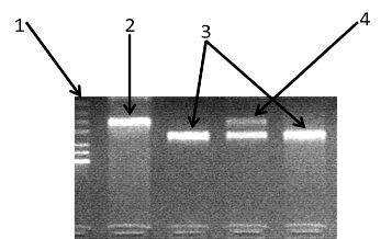 электрофореграмма разделения фрагментов днк амплифицированного участка rs2278815 гена lep в 3% агарозном геле