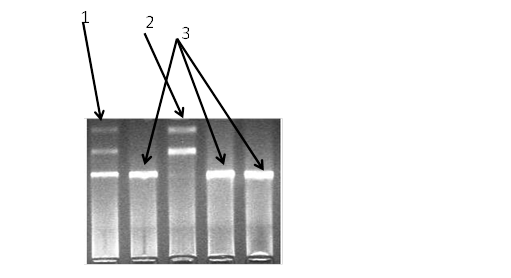 электрофореграмма разделения фрагментов днк амплифицированного участка rs2167270 гена lep в 3% агарозном геле