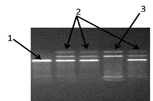 электорофореграмма разделения фрагментов днк амплифицированного участка rs11763517 гена lep в 3% агарозном геле