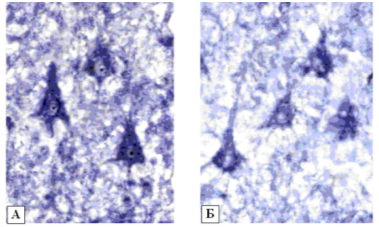активность надн-дг в нейронах 5 слоя теменной коры мозга[16]