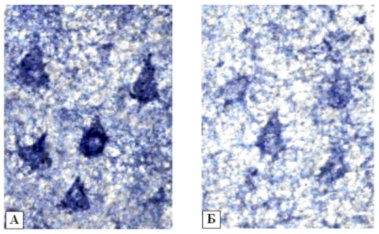 активность г-6-фдг в нейронах 5 слоя теменной коры[16]